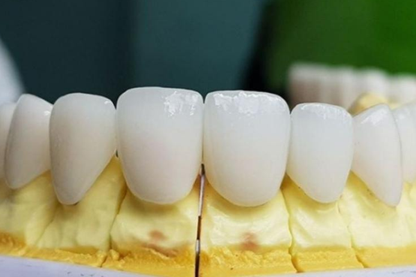 Cách nhận biết răng sứ Zirconia