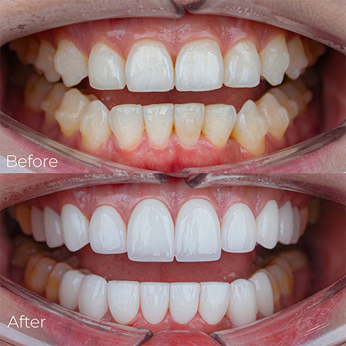 Cảm nhận khách hàng