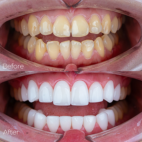 Cảm nhận khách hàng