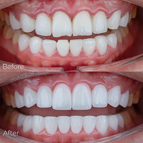 Cảm nhận khách hàng